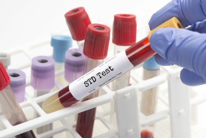 STD test  blood analysis collection tube selected by technician.  Serial number is random, labels and document are fictitious and created by the photographer.